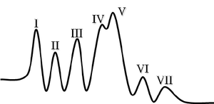 brainstem-auditory-evoked-potential-baep-waveforms