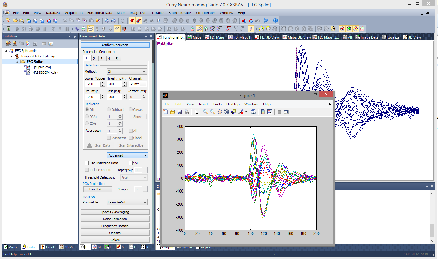 How to crack matlab 2017