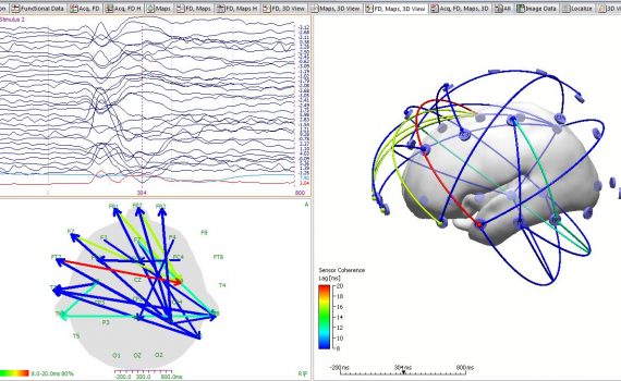 2D and 3D coherence between sensors