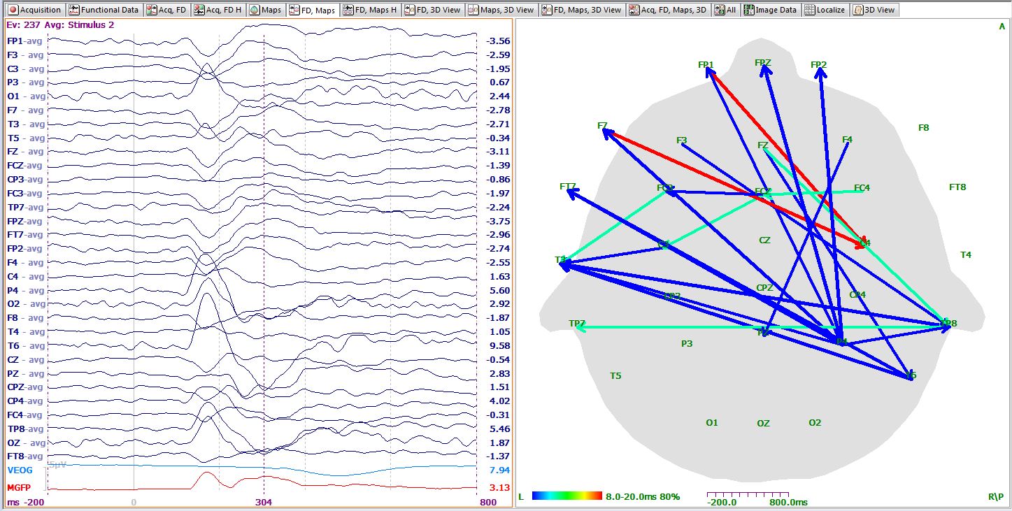 2D Coherence display in Curry