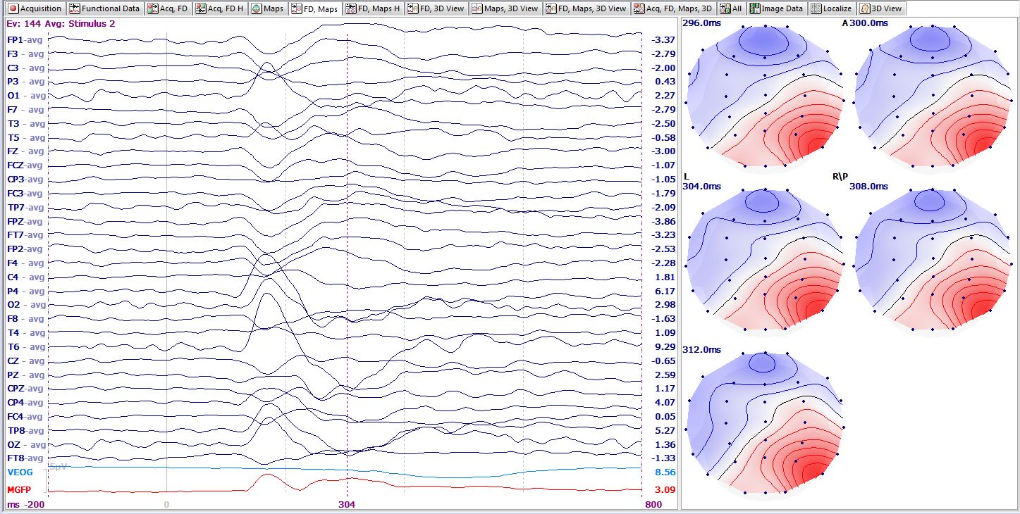 Average waveforms shown with 2D maps