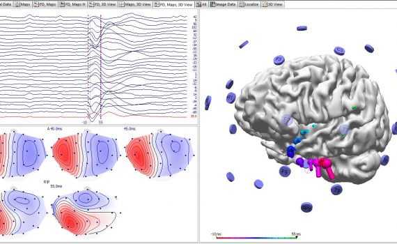 Moving dipole analysis in Curry