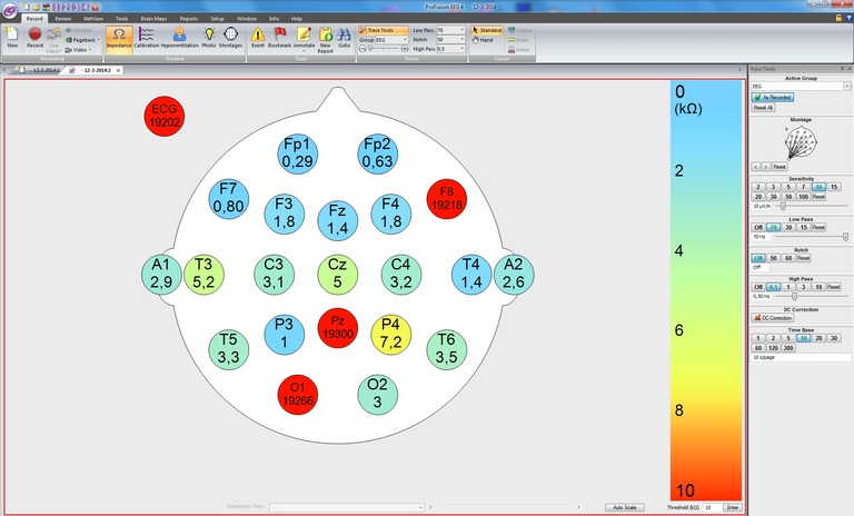 Profusion Eeg Impedance Compumedics Neuroscan
