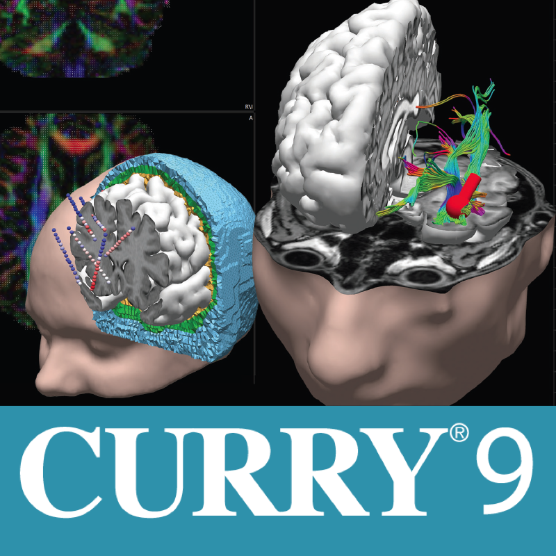 CURRY 9 S – Signal Processing – Compumedics Neuroscan