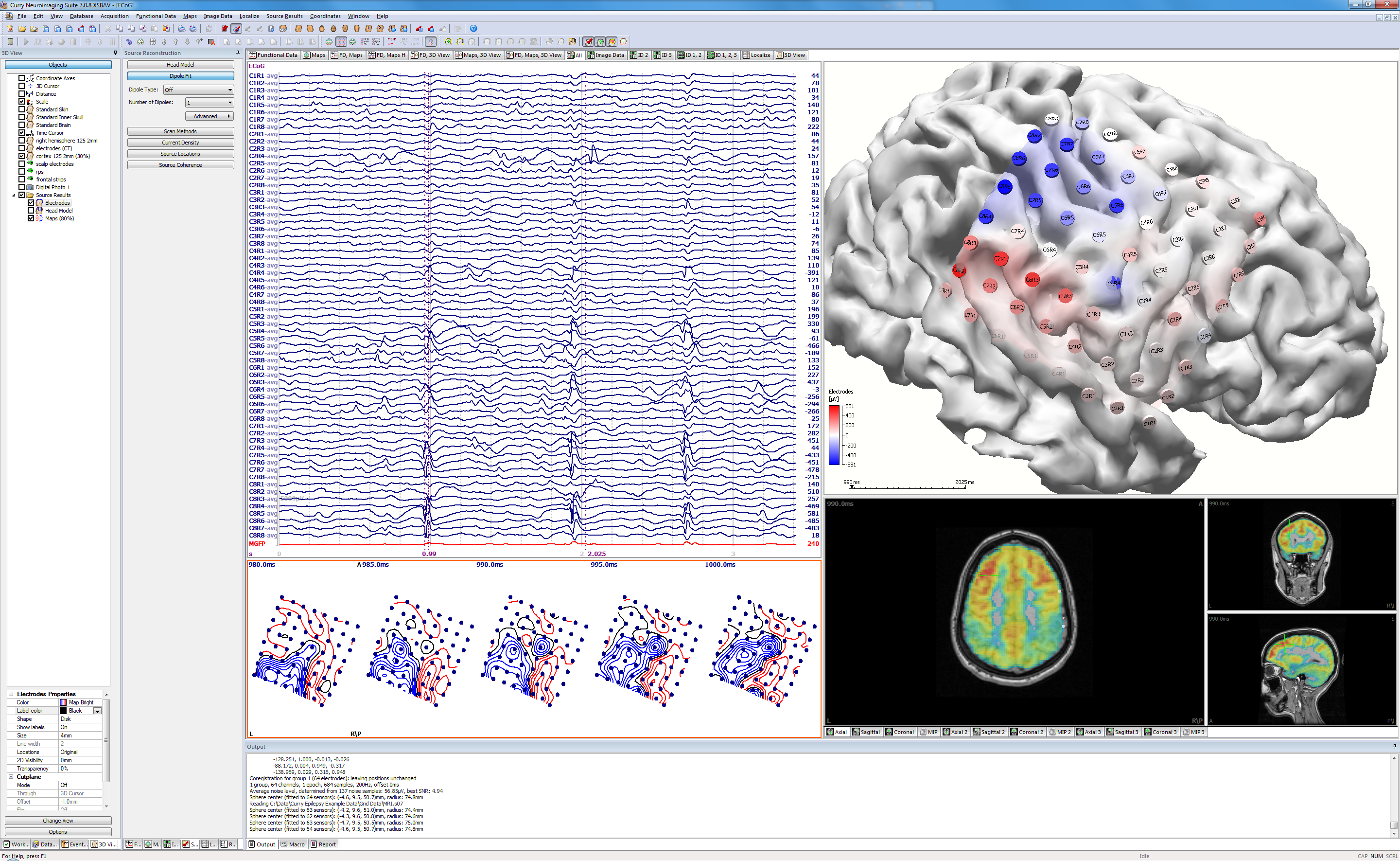 Иммунная карта Нейро. Нейро Графика. EEG. Neuroscan Curry.