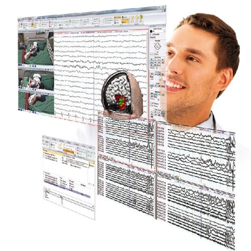 profusion-eeg – Compumedics Neuroscan profusion-eeg – Compumedics Neuroscan